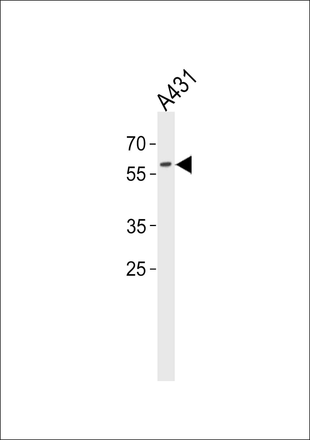 PAX3 Antibody (aa98-126)