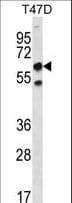 SCP2 / SCPX Antibody (aa14-43)