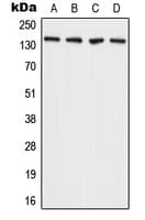 Polyclonal Rabbit anti-Human ADAMTS2 Antibody (C-Terminus, WB)