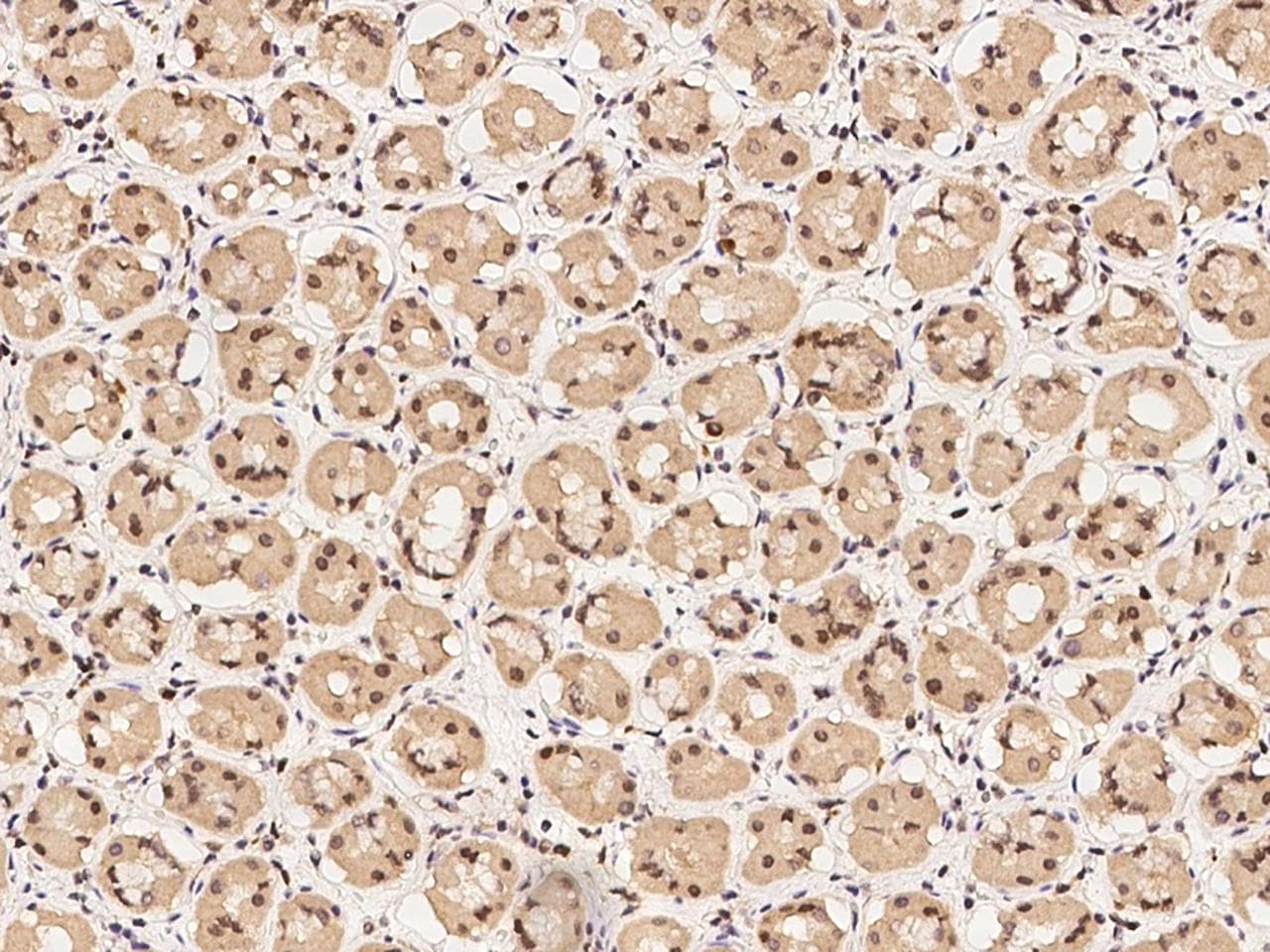 MYST2 / HBO1 Antibody