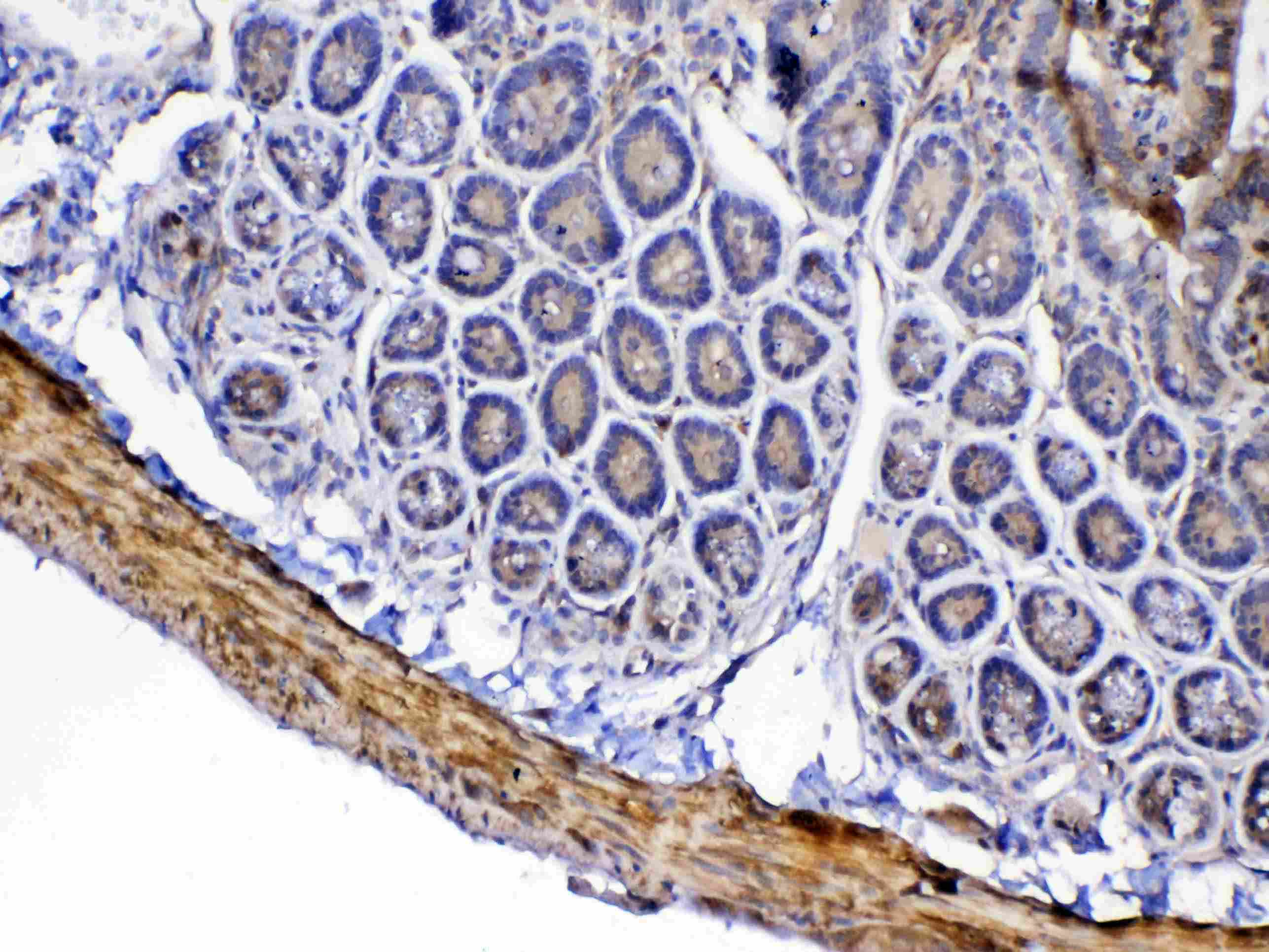 CFD / Factor D / Adipsin Antibody