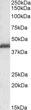 IHC-plus™ Polyclonal Goat anti-Human PAFAH1B1 / LIS1 Antibody (aa397-410, IHC, WB)