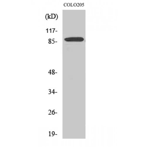 Polyclonal Rabbit anti-Human EWSR1 / EWS Antibody (380-460 aa, Internal, WB)