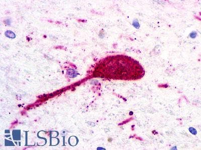 PathPlus™ Polyclonal Rabbit anti-Human CHEMR23 / CMKLR1 Antibody (N-Terminus, IHC)