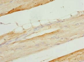 PITRM1 / MP1 Antibody