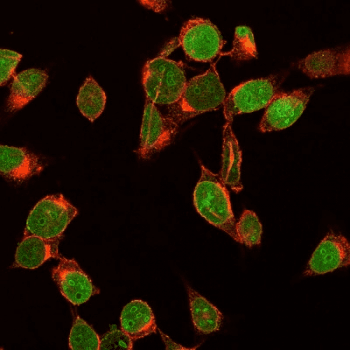 MKI67 / Ki67 Antibody (clone MKI67/2461)