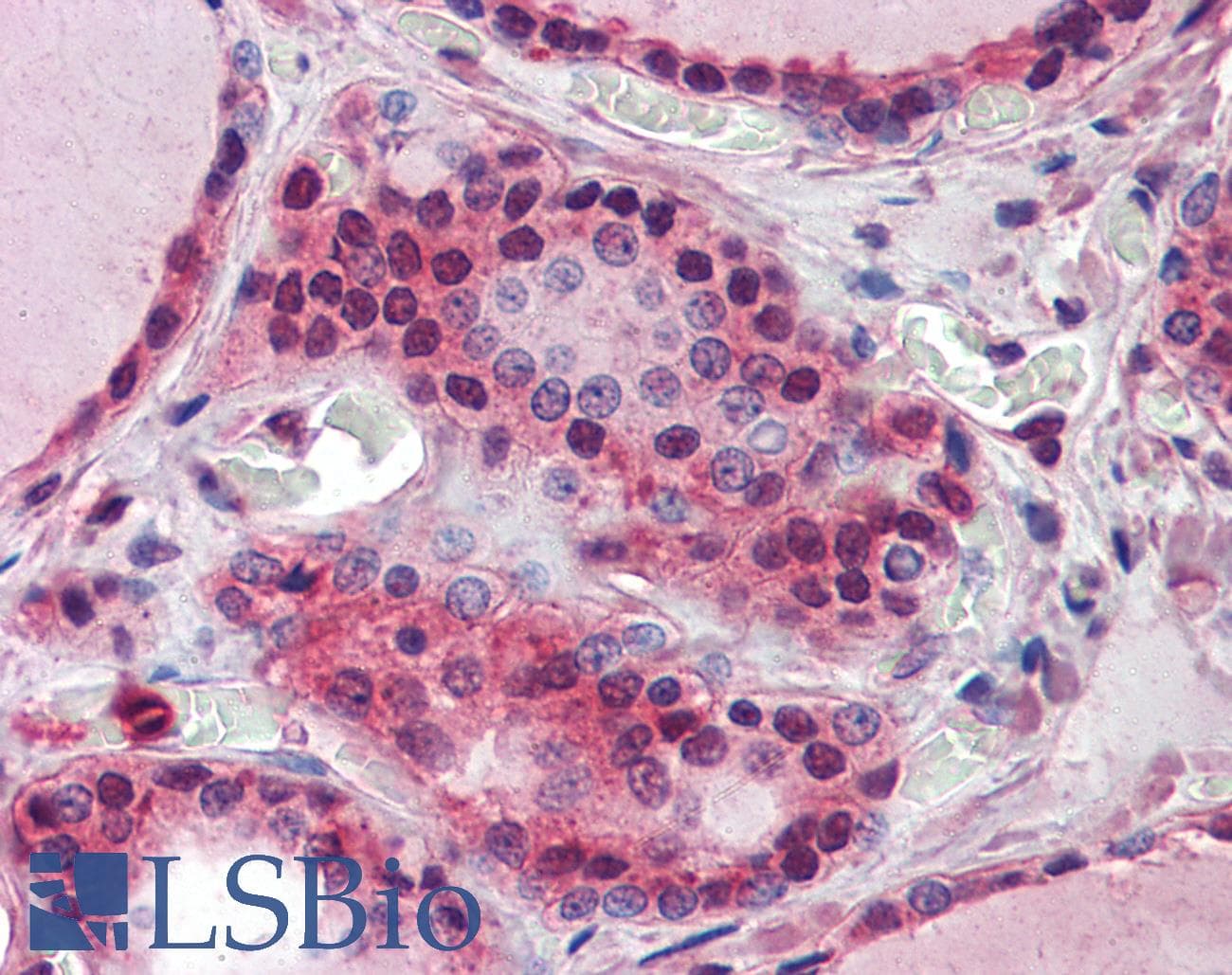 IHC-plus™ CANX / Calnexin Antibody (clone 3H4A7)