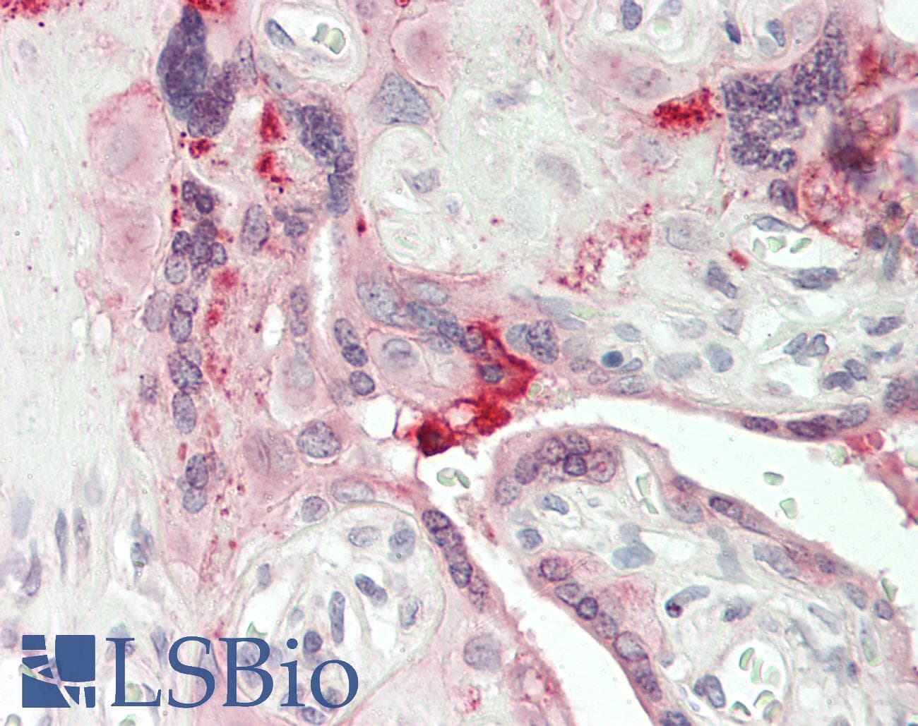 IHC-plus™ DKK2 Antibody (aa31-62)