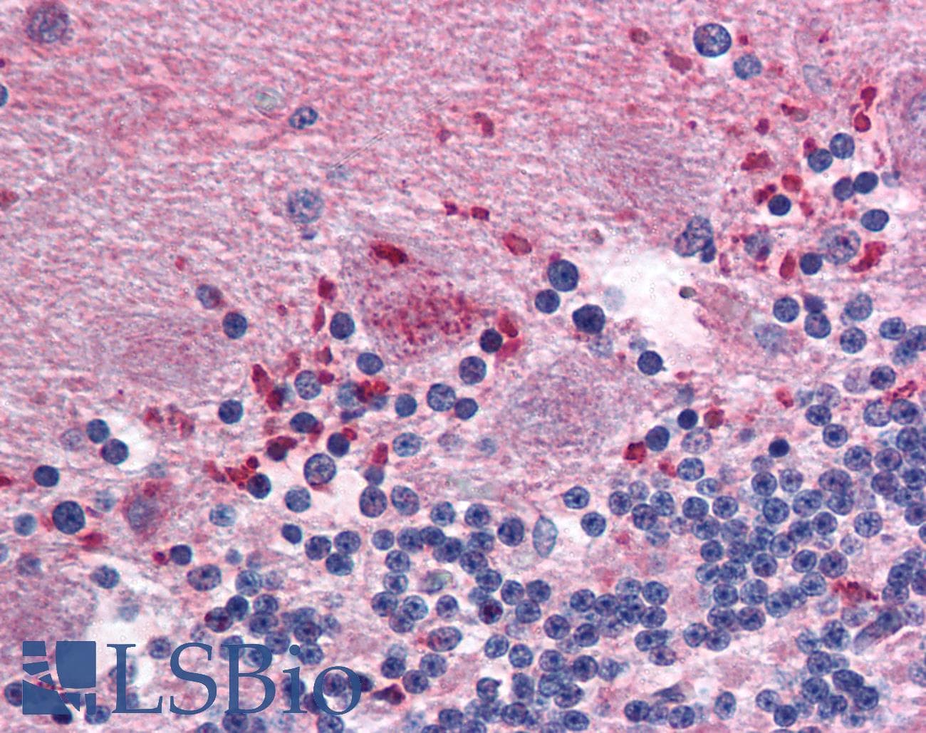 IHC-plus™ CLDN12 / Claudin 12 Antibody (N-Terminus)
