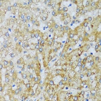 Polyclonal Rabbit anti-Human C1QG / Complement C1QC Antibody (IHC)