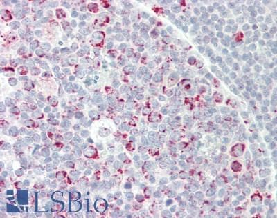 CSTF2 / CstF-64 Antibody (aa182-231)