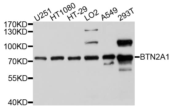 Polyclonal Rabbit anti-Human BTN2A1 Antibody (WB)