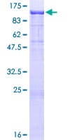 Human ACAN / Aggrecan Protein (Recombinant GST)