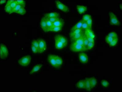 Polyclonal Rabbit anti-Human NANS Antibody (IF, WB)