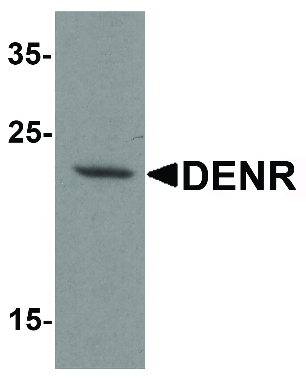 DENR / Density Regulated Antibody
