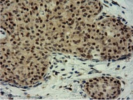 EPM2AIP1 Antibody (clone OTI2G3)