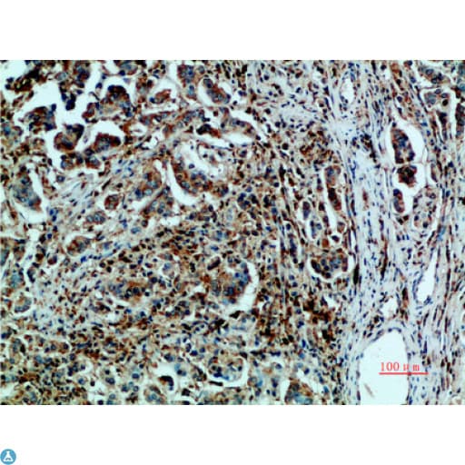 Polyclonal Rabbit anti-Human HSPA5 / GRP78 / BiP Antibody (WB)
