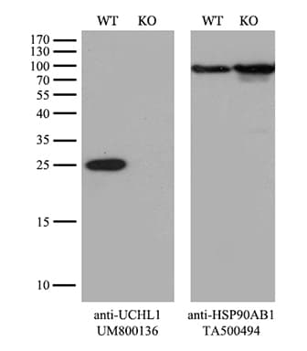 UCHL1 / PGP9.5 Antibody (clone UMAB244)