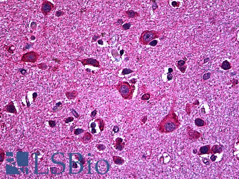 IHC-plus™ EPHB6 / EPH Receptor B6 Antibody (clone 5D8)