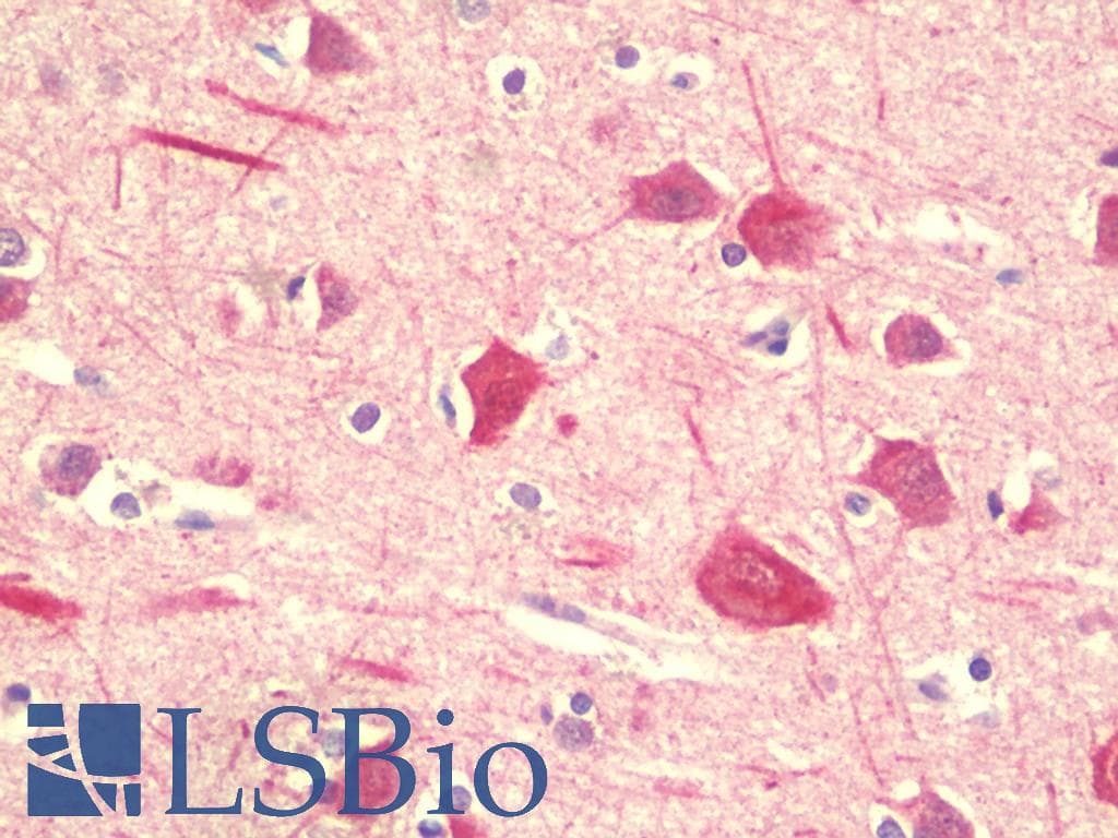IHC-plus™ Polyclonal Rabbit anti-Human PPHLN1 Antibody (IHC, IF, WB)
