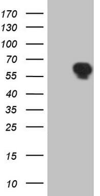 TRIB1 Antibody (clone OTI1F11)