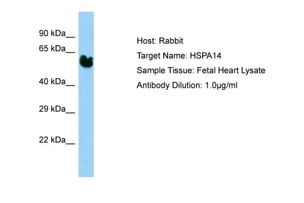 Polyclonal Rabbit anti-Human HSP70L1 / HSPA14 Antibody (aa37-86, WB)