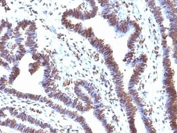 FBXO5 / EMI1 Antibody (aa1-250, clone EMI1/1176)