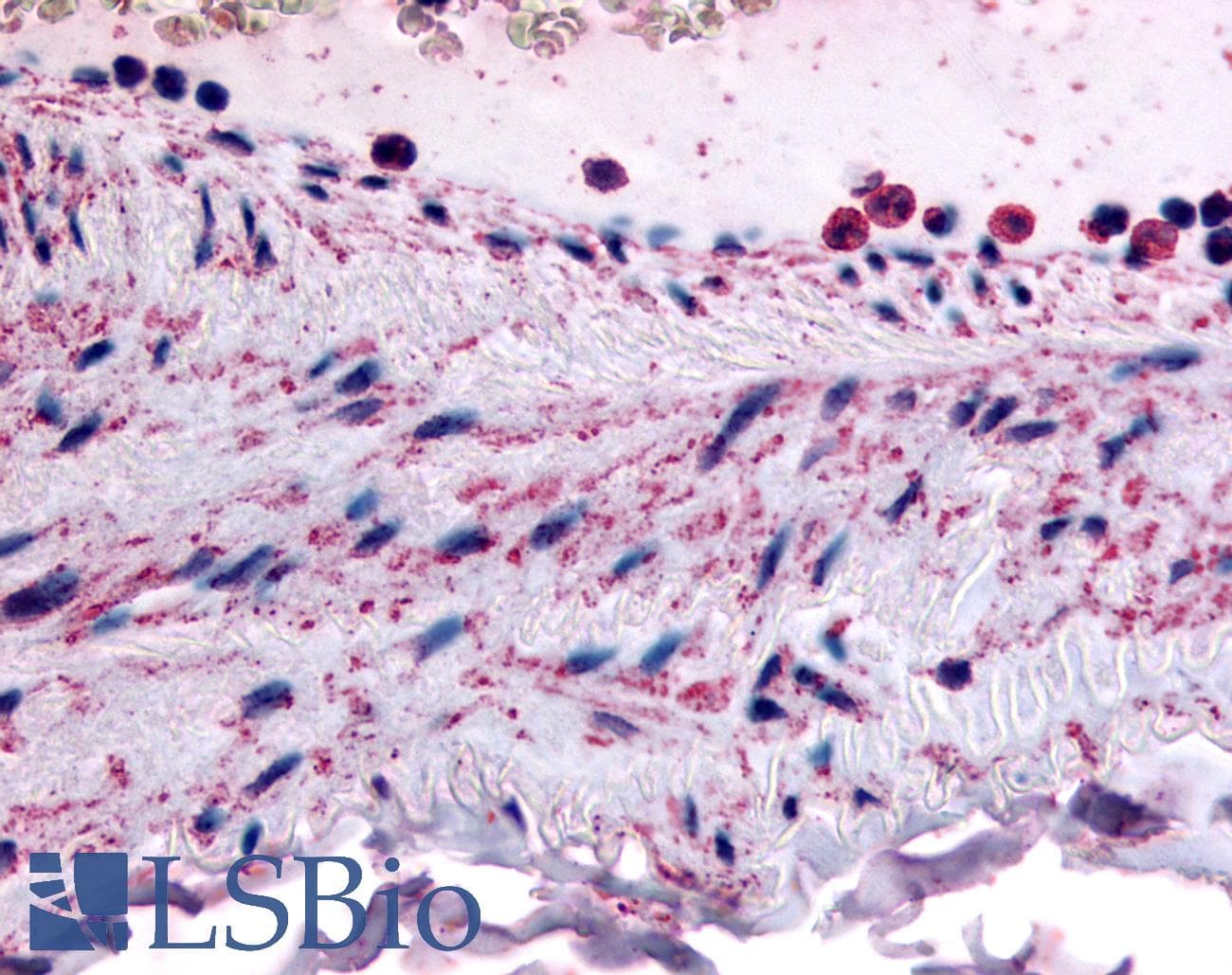 IHC-plus™ Polyclonal Rabbit anti-Human PTPMT1 Antibody (N-Terminus, IHC)
