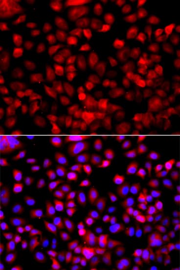 FASN / Fatty Acid Synthase Antibody