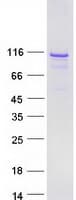 Human BEND3 Protein (Recombinant Myc-DDK (Flag))
