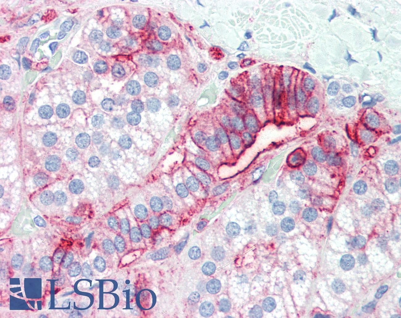 PathPlus™ CD44 Antibody (clone MEM-85)