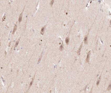 Polyclonal Rabbit anti-Human FGFR3 Antibody (IHC, IF, WB)
