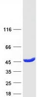 Human GMPR2 Protein (Recombinant Myc-DDK (Flag))