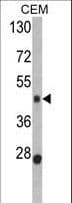 BMP15 Antibody (aa241-271)