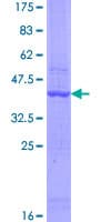 Human AASDH / ACSF4 Protein (Recombinant GST)