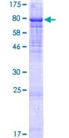 Human PIP5K1B Protein (Recombinant GST)