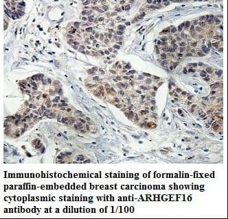 Polyclonal Rabbit anti-Human ARHGEF16 Antibody (aa84-256, IHC, WB)