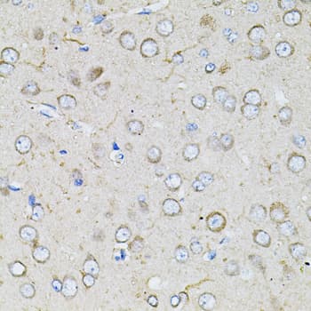 BEST1 / BEST / Bestrophin Antibody