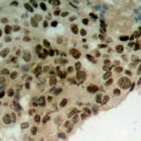 TOR1A / Torsin A Antibody