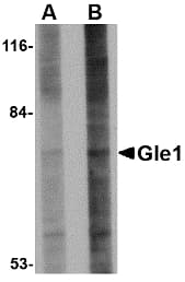 IHC-plus™ Polyclonal Rabbit anti-Human GLE1 Antibody (IHC, IF, WB)