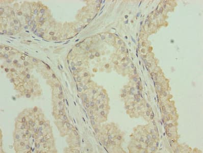 CLEC3A Antibody