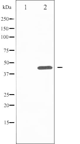 Polyclonal Rabbit anti-Human MAPK8 / JNK1 Antibody (phospho-Tyr185, IHC, IF, WB)