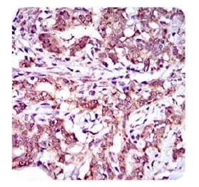 ABCG5 Antibody (aa300-500, clone 1B5E10)