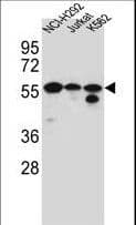 FOXN2 Antibody (aa1-30)