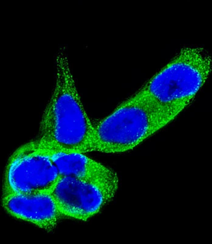 DPYSL5 / CRMP5 Antibody (clone 1503CT789.209.250.52)