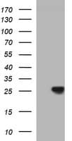CHAC1 / MGC4504 Antibody (clone OTI4B3)