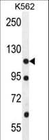 ECT2L Antibody (aa725-753)