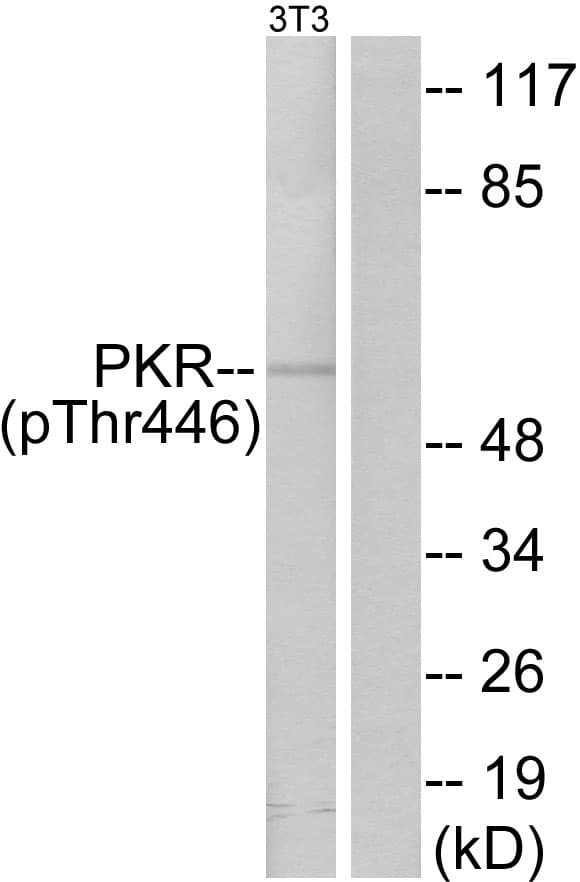 EIF2AK2 / PKR Antibody (phospho-Thr446)