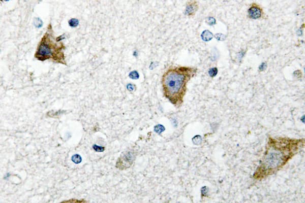 RPS20 / Ribosomal Protein S20 Antibody (Lys67)