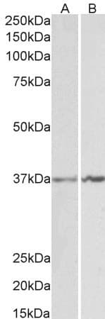 IHC-plus™ ANXA1 / Annexin A1 Antibody (aa324-337)